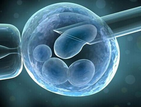 体外受精 IVF-ET